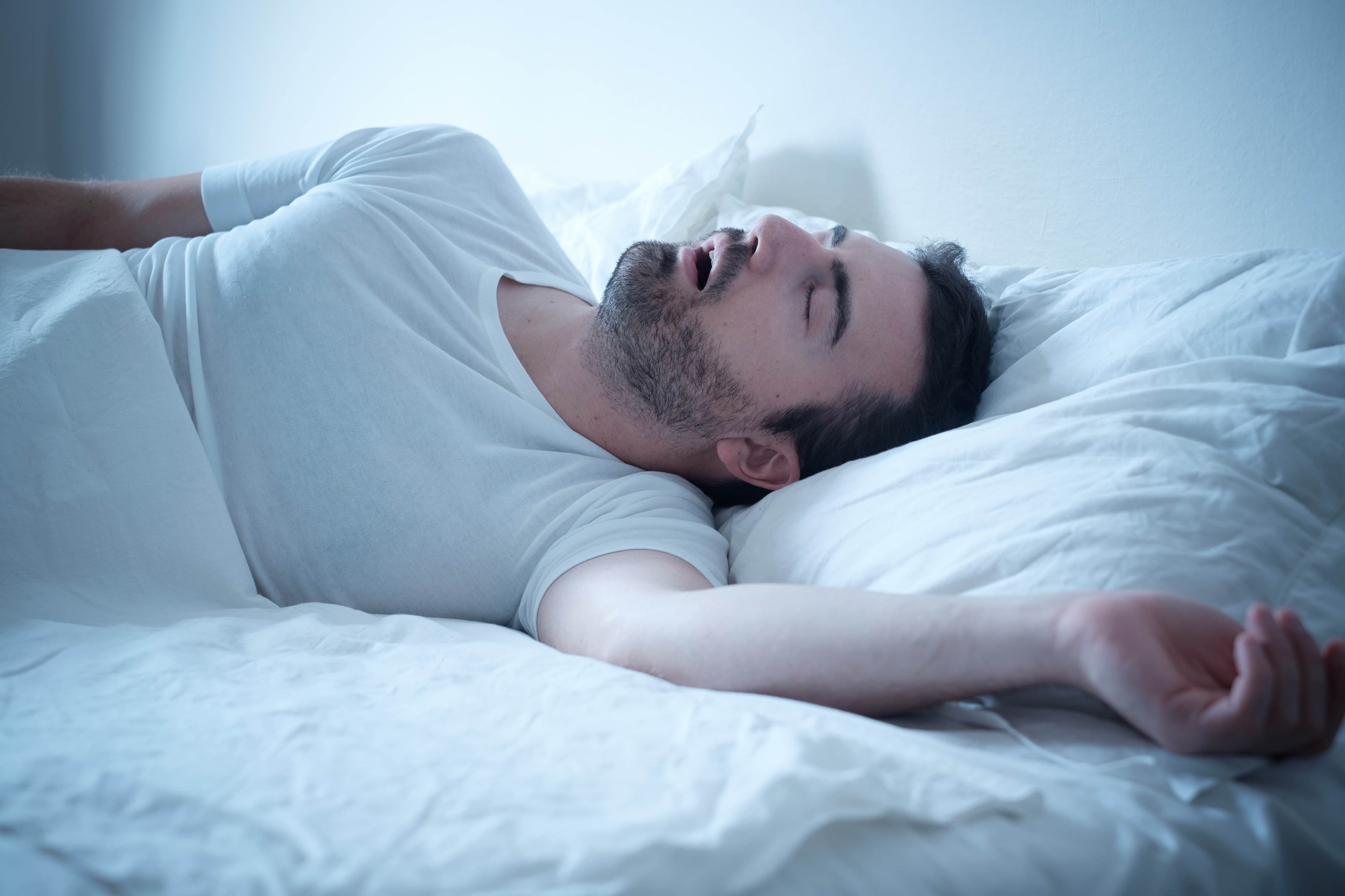Man lying on his back asleep with his mouth open in a white bed